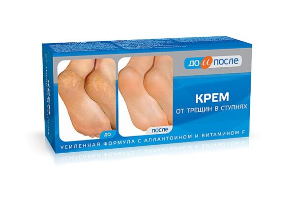 fullsize До и После Крем, от трещин стоп, 150 мл
